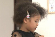 母親「ウチの娘、かなり稀な症状で生まれて髪の毛が黒人みたいな縮毛なんです」