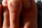 俺の爪がグロいと話題に（※画像あり）