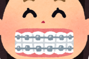 歯列矯正して後悔してるやつwww