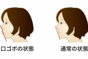 口ゴボの人が少しでも綺麗に見せるには？