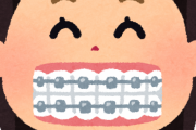 歯の矯正っていくらかかるの？？