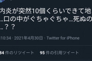 【悲報】大人気声優の鬼頭明里さん、突然口内炎が10個もできてしまう