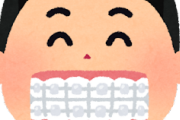【疑問】歯列矯正したいけどいくらするんや？ｗｗｗ