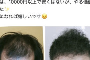 【画像】1万円で完璧に「ハゲ隠し」ができる髪型が見つかるｗｗｗｗ