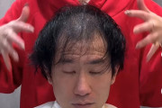 【画像】美容師ならこのハゲがこうなるってよ！