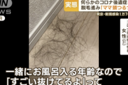 【画像】30代女性、コロナ後遺症でツルツルになる…