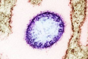 【危険】ワクチンも治療法もない「ニパウイルス感染症」が、インドで大流行の兆し