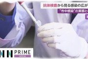【新型コロナ】神戸市研究チームが外来患者1000人に抗体検査 ⇒ 3.3%に抗体、市民４万人感染歴か