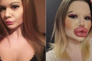 【画像】整形手術を重ねると美的感覚が狂うのかな？