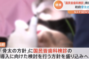 政府、全国民に毎年歯科検診義務付けを検討へ