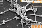 【緊急】『マイコプラズマ肺炎』過去最多