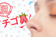 いちご鼻が治った方いますか？
