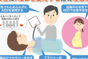 【朗報】市役所「女性へのAED使用はこちらの注意点を守るだけでOKです」