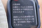 AppleWatch「心臓おかしいで。医師に相談するとええで」　←診察の結果、アウトでした