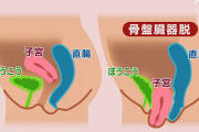 【画像】女性、子宮が飛び出す…『自分の臓器って見たことないですよね？』