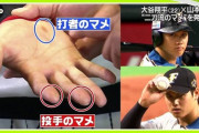 【画像】大谷翔平の爪、思ったよりとんでもない事になってたｗｗｗｗｗｗｗｗ