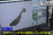 「オキシトシン」に毛の成長促す働き神奈川の研究所など発表|NHK