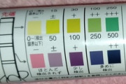 【画像】5日間毎食『ロキソニン』飲んだ俺が尿検査キット使った結果…