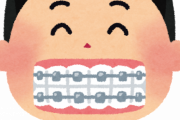 【悲報】歯列矯正1日目ワイ、発狂・・・・・・・・・・・・・・・・・・・・・・・・・