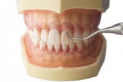 「歯の歯石取り」←これより痛い拷問て存在するの？