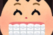 【画像】 ガチャ歯の女子、歯列矯正を3ヶ月やった結果が凄すぎるｗｗと話題に