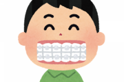 【朗報】ワイ、この1年で貯めた80万円で歯列矯正を決意