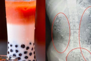 【閲覧注意】中国人少女がタピオカ飲んで腹痛、レントゲンを撮るとそこには・・・！