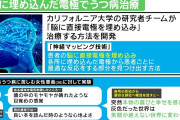 【画像】うつ病「死にたい…」 医師「ほーいｗ」（脳に電極埋め込む）