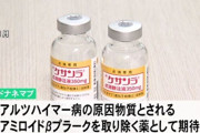 初投与された認知症新薬「ドナネマブ」 70代女が治療完了