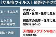 【緊急】東京でサル痘初確認、なお「治療法はなし」 ←ｗｗｗｗｗｗｗｗｗ