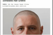 カリフォルニア大学が『ハゲを治す新分子』を発見、脱毛症の画期的な治療薬になる可能性（海外の反応）