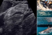 【動画】母親の子宮内でうごめく『サメ』の赤ちゃん、超音波で撮影される　　