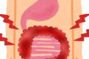 【悲報】「大腸がん」急増…