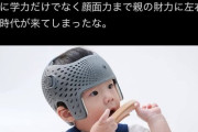 【画像】最近の赤ちゃん、ヘルメットを被らされる