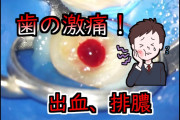歯医者「歯周ポケットが腐って膿が出てきてます」ワイ「臭いですか？w?」