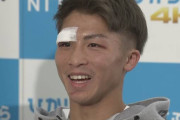 【悲報】井上尚弥、目と鼻を骨折していた